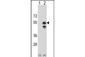 Western blot analysis of CPN1 (arrow) using rabbit polyclonal CPN1 Antibody (N-term) (ABIN391509 and ABIN2841471).