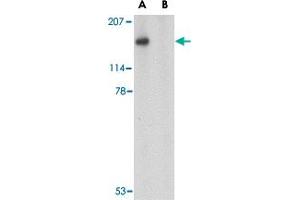 Western blot analysis of SLITRK5 in NIH/3T3 cell lysate with SLITRK5 polyclonal antibody  at 1 ug/mL in the (A) absence or (B) presence of blocking peptide. (SLITRK5 anticorps  (Internal Region))