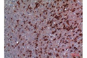 Immunohistochemistry (IHC) analysis of paraffin-embedded Rat Brain, antibody was diluted at 1:100.