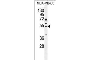 CCNB1 Antibody (Center) (ABIN655048 and ABIN2844676) western blot analysis in MDA-M cell line lysates (35 μg/lane). (Cyclin B1 anticorps  (AA 241-268))