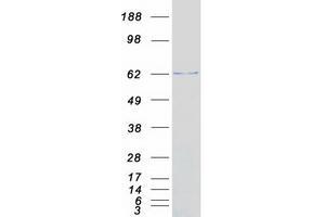 Validation with Western Blot