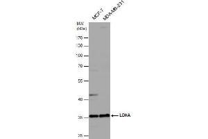 WB Image Various whole cell extracts (30 μg) were separated by 10% SDS-PAGE, and the membrane was blotted with LDHA antibody , diluted at 1:1000. (Lactate Dehydrogenase A anticorps)