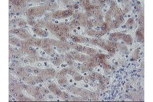 Immunohistochemical staining of paraffin-embedded Human liver tissue using anti-C20orf3 mouse monoclonal antibody.