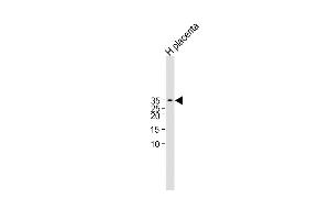 All lanes : Anti-CGB/HCG-Beta Antibody (C-term)at 1:1000 dilution Lane 1:Human placenta lysate Lysates/proteins at 20 μg per lane. (CGB anticorps  (C-Term))