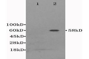 L1 Mouse cerebrum lysates, L2 mouse liver lysates probed with Anti- CD122/IL-2RB Polyclonal Antibody, Unconjugated (ABIN675923) at 1:300 in 4 °C. (IL2 Receptor beta anticorps  (AA 501-551))