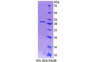 SDS-PAGE analysis of Mouse AFAP1 Protein.