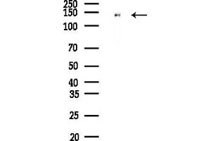 Western blot analysis of lysates from HepG2 cells(LPS, 4h treatment), using MAML2 Antibody at 1/1000 dilution.