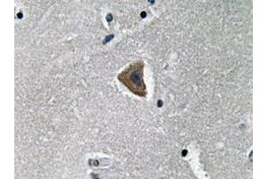 Immunohistochemistry analyzes of Rock-1 antibody in paraffin-embedded human brain tissue. (ROCK1 anticorps)