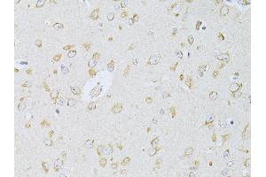 Immunohistochemistry of paraffin-embedded rat brain using NTS antibody (ABIN5998396) at dilution of 1/100 (40x lens).