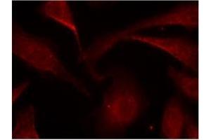 Image no. 3 for anti-Nuclear Factor-kB p65 (NFkBP65) (pSer529) antibody (ABIN196955) (NF-kB p65 anticorps  (pSer529))