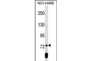 SCML2 Antibody (Center) (ABIN1538338 and ABIN2849362) western blot analysis in NCI- cell line lysates (35 μg/lane). (SCML2 anticorps  (AA 348-375))