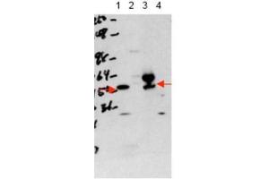 Western blot using  affinity purified anti-THRA antibody shows detection of purified recombinant THRA (lane 1) and THRA present in a 293 cell lysate after transient transfection with THRA (lane 3).