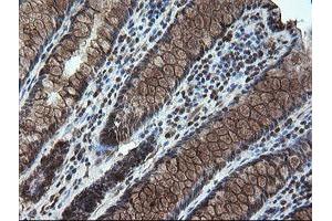 Image no. 1 for anti-serine/threonine Kinase 38 Like (STK38L) (AA 1-281) antibody (ABIN1490699)