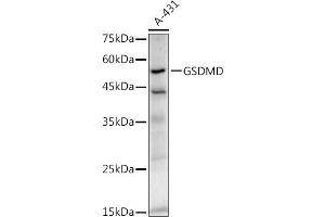 Western blot analysis of extracts of A-431 cells, using GSDMD antibody (ABIN7267352) at 1:1000 dilution. (GSDMD anticorps)