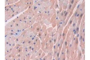 DAB staining on IHC-P;;Samples: Mouse Heart Tissue (FABP3 anticorps  (AA 1-133))