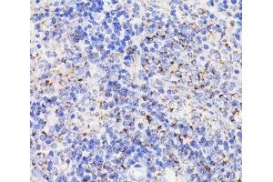 Immunohistochemistry of paraffin-embedded Rat spleen using PDCD10 Polyclonal Antibody at dilution of 1:100 (40x lens).