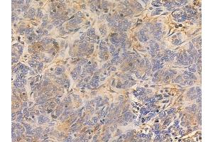 ABIN6260112 and ABIN6277506 at 1/100 staining human thymoma by IHC-P. (ATL1 anticorps  (N-Term))