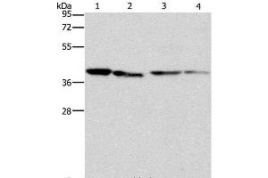 Western Blot analysis of Human placenta tissue and NIH/3T3 cell, Raji and hepG2 cell using BCAT2 Polyclonal Antibody at dilution of 1:312. (BCAT2 anticorps)