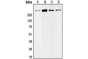 Western blot analysis of UBR5 expression in Jurkat (A), HeLa (B), MDAMB468 (C), NIH3T3 (D) whole cell lysates.
