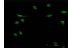 Immunofluorescence of monoclonal antibody to EIF1AY on HeLa cell.