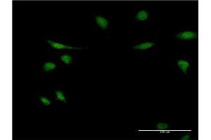 Immunofluorescence of monoclonal antibody to EIF1AY on HeLa cell. (EIF1AY anticorps  (AA 22-95))