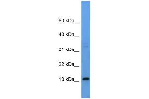 anti-Cysteine/tyrosine-Rich 1 (CYYR1) (Middle Region) antibody