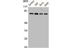 Western Blot analysis of Jurkat 293 HELA A549 cells using Actinin-α1/2/3/4 Polyclonal Antibody (ACTN1/ACTN2/ACTN3/ACTN4 (N-Term) anticorps)
