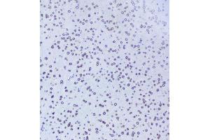 IHC analysis of TPR using anti-TPR antibody (ABIN5693275). (TPR anticorps)