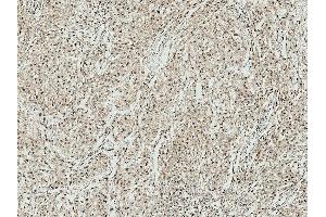 Immunohistochemistry analysis using Rabbit Anti-ATG10 Polyclonal Antibody (ABIN5065889).