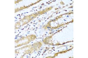 Immunohistochemistry of paraffin-embedded human stomach using UBE2L3 antibody (ABIN5972307) at dilution of 1/100 (40x lens). (UBE2L3 anticorps)