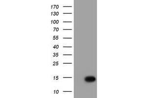 Western Blotting (WB) image for anti-Chromosome 17 Open Reading Frame 37 (C17orf37) antibody (ABIN1501781) (C17orf37 anticorps)