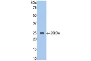 Western blot analysis of recombinant Mouse CPB2/TAFI. (CPB2 anticorps  (AA 187-327))