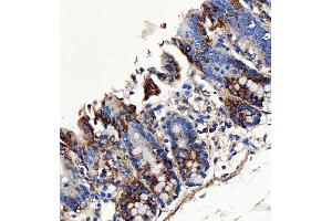 IHC analysis of SH2D4A using anti-SH2D4A antibody (ABIN7601695). (SH2D4A anticorps  (AA 42-454))