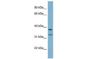 RALGPS2 antibody used at 1 ug/ml to detect target protein.