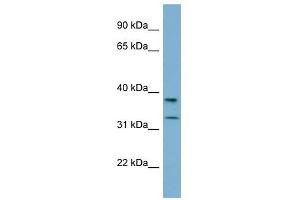 RALGPS2 antibody used at 1 ug/ml to detect target protein. (RALGPS2 anticorps  (N-Term))