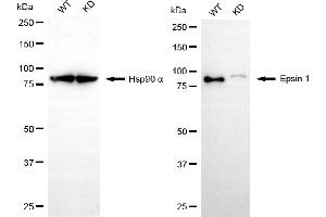 Western blotting analysis using epsin 1 antibody (ABIN7798486).