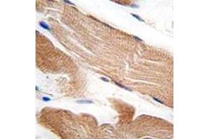 IHC analysis of FFPE human skeletal muscle tissue stained with ILK1 antibody