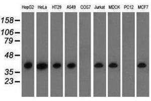 Image no. 4 for anti-3-hydroxyisobutyryl-CoA Hydrolase (HIBCH) antibody (ABIN1498658)