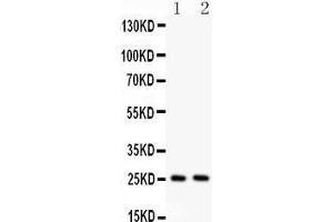 Anti- TNF alpha Picoband antibody, Western blotting All lanes: Anti TNF alpha  at 0. (TNF alpha anticorps  (AA 80-227))
