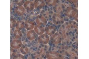 Used in DAB staining on fromalin fixed paraffin- embedded Kidney tissue