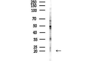 Western blot analysis of lysates from COLO205 cells(heat-shock,45 min treatment), using Phospho-Stathmin 1 (Ser38) Antibody at 1/1000 dilution.