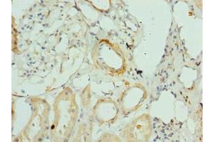 Immunohistochemistry of paraffin-embedded human kidney tissue using ABIN7144163 at dilution of 1:100 (ANKMY1 anticorps  (AA 1-220))