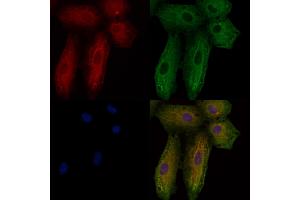 ABIN6257398 and ABIN6276108 staining  cells by IF/ICC. (Rho-related GTP-binding protein anticorps)