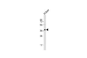Anti-LMX1A Antibody (C-term)at 1:2000 dilution + human liver lysates Lysates/proteins at 20 μg per lane.