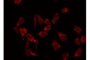 ABIN6267068 staining Hela by IF/ICC.