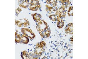 Immunohistochemistry of paraffin-embedded human gastric using RIPK4 antibody at dilution of 1:100 (x40 lens).