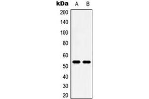 Western blot analysis of 5-HT2B expression in HeLa (A), HT29 (B) whole cell lysates. (Serotonin Receptor 2B anticorps  (N-Term))