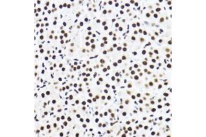 Immunohistochemistry of paraffin-embedded rat ovary using SF3 Rabbit pAb (ABIN1682671, ABIN3018959, ABIN3018960 and ABIN6220644) at dilution of 1:100 (40x lens).