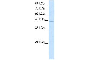 WB Suggested Anti-COLQ Antibody   Titration: 1. (COLQ anticorps  (N-Term))