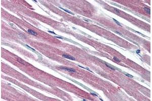 Human Heart (formalin-fixed, paraffin-embedded) stained with S100A1 antibody ABIN790334 at 10 ug/ml followed by biotinylated goat anti-rabbit IgG secondary antibody ABIN481713, alkaline phosphatase-streptavidin and chromogen. (S100A1 anticorps  (C-Term))